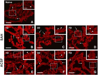 Subarachnoid Hemorrhage Increases Level of Heme Oxygenase-1 and Biliverdin Reductase in the Choroid Plexus